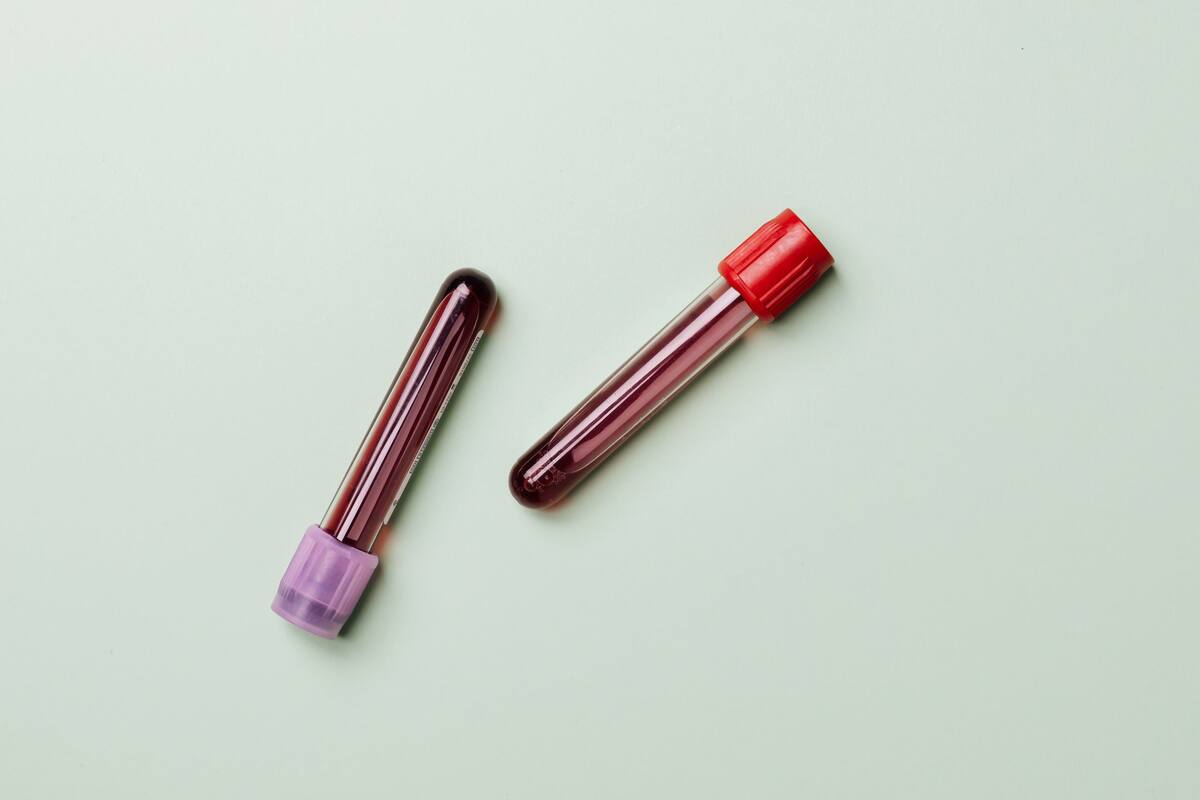 Imagen ilustrativa de tubos con muestras de sangre. FOTO: PEXELS