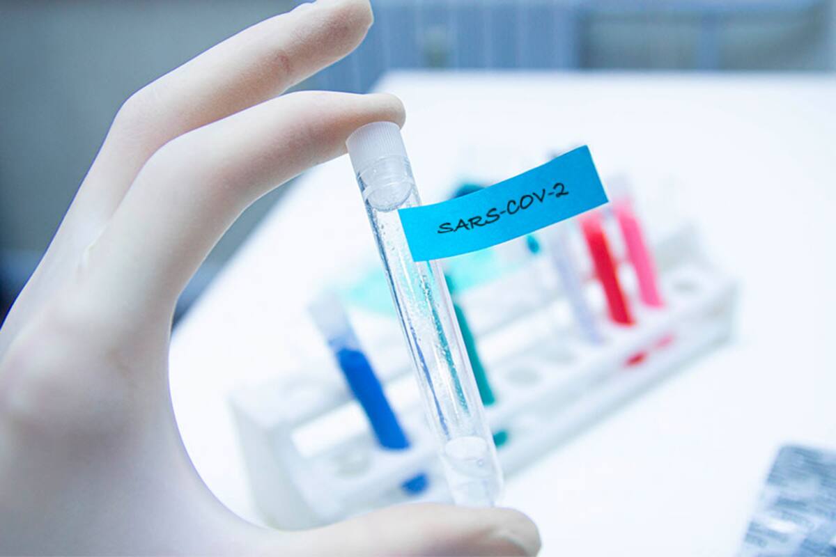 Científicos del CIAD desarrollan prueba para detectar anticuerpos en personas recuperadas del COVID-19