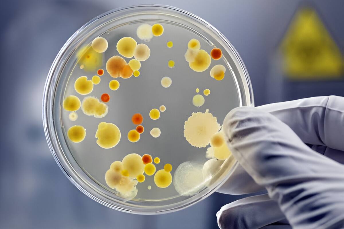 ¿Qué es una bacteria?