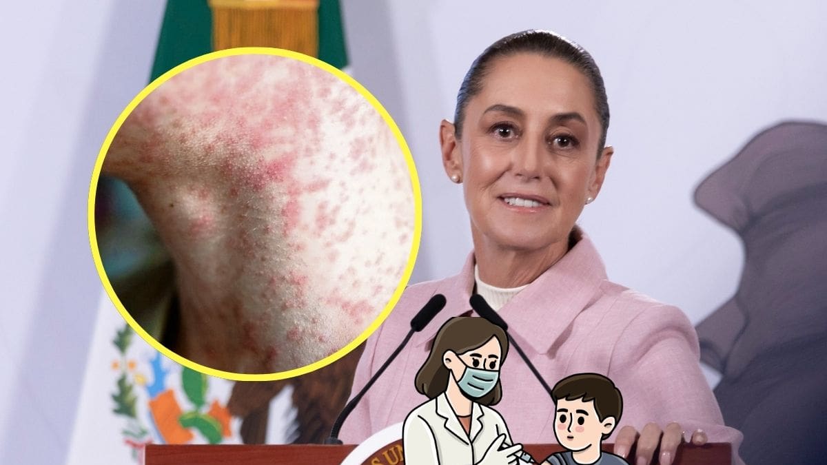 Sonora se suma a estrategia prioritaria de vacunación contra sarampión tras aumento de casos activos; acumula 166 contagios y se ubica entre las entidades con mayor incidencia, mientras Salud reporta 29 defunciones a nivel nacional y llama a inmunizar a menores y personas de 13 a 49 años