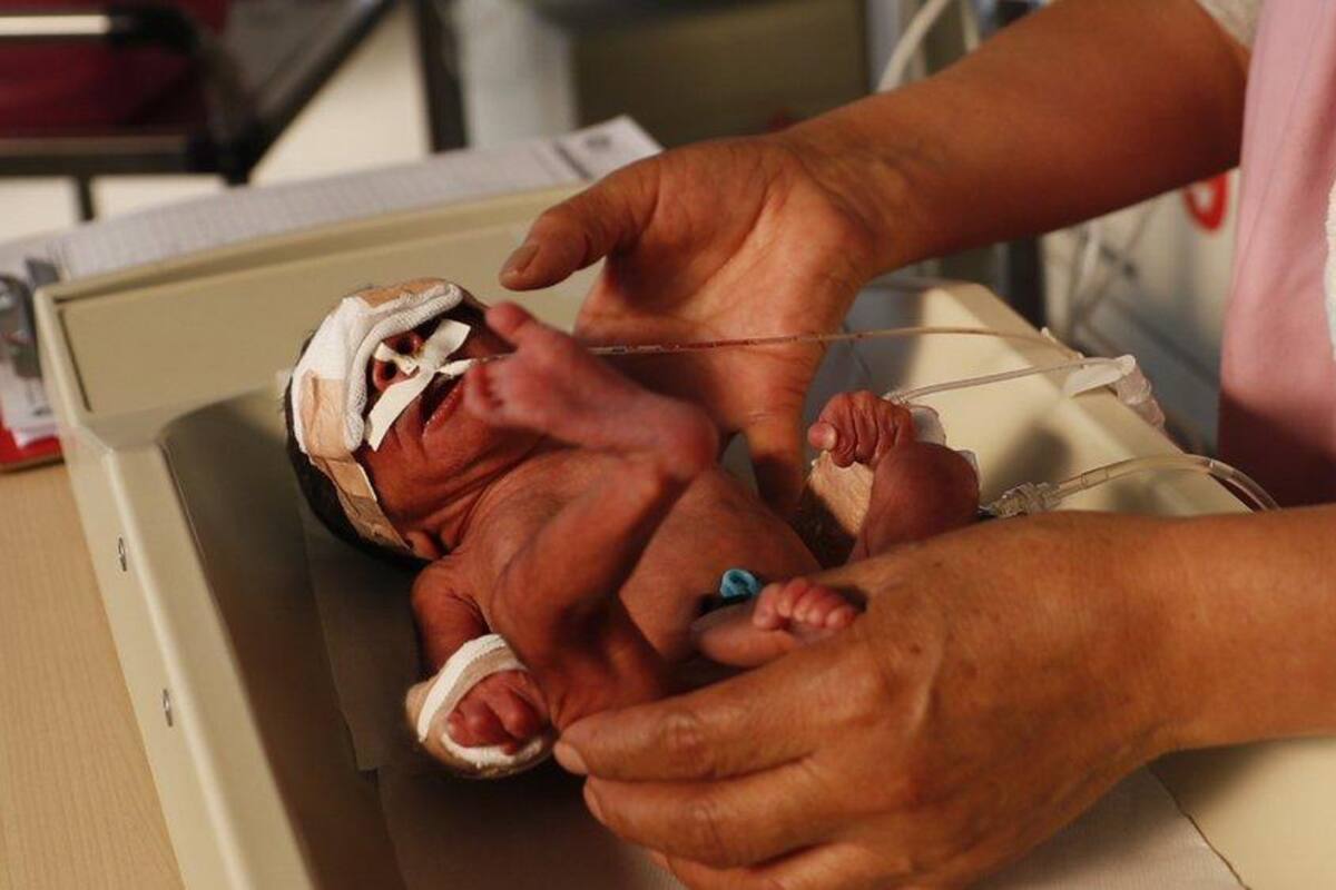 Bebés prematuros conectados a respirador, los más vulnerables ante protestas en Bolivia