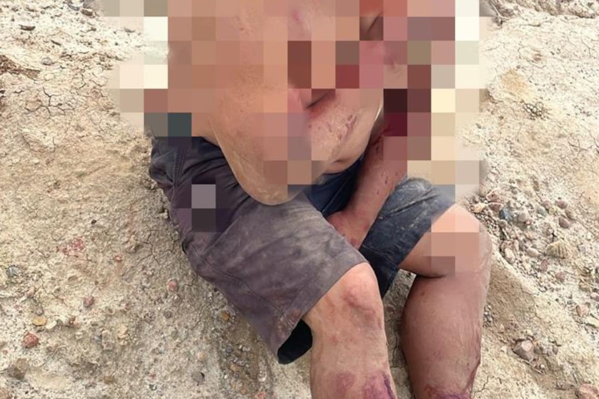 Sujetos armados golpean a hombre y hieren a perro en pleito de tierras
