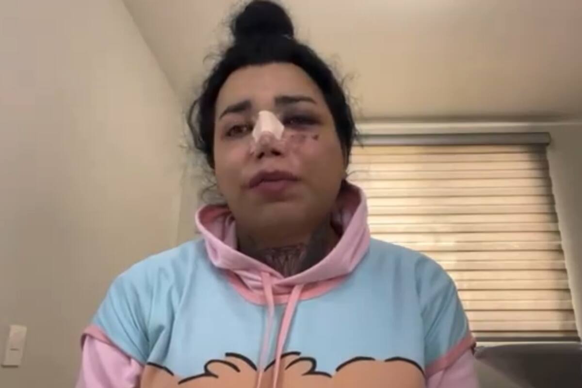 Paola Suárez revela que el "golpe al corazón" le dolió más que la agresión de su ex novio