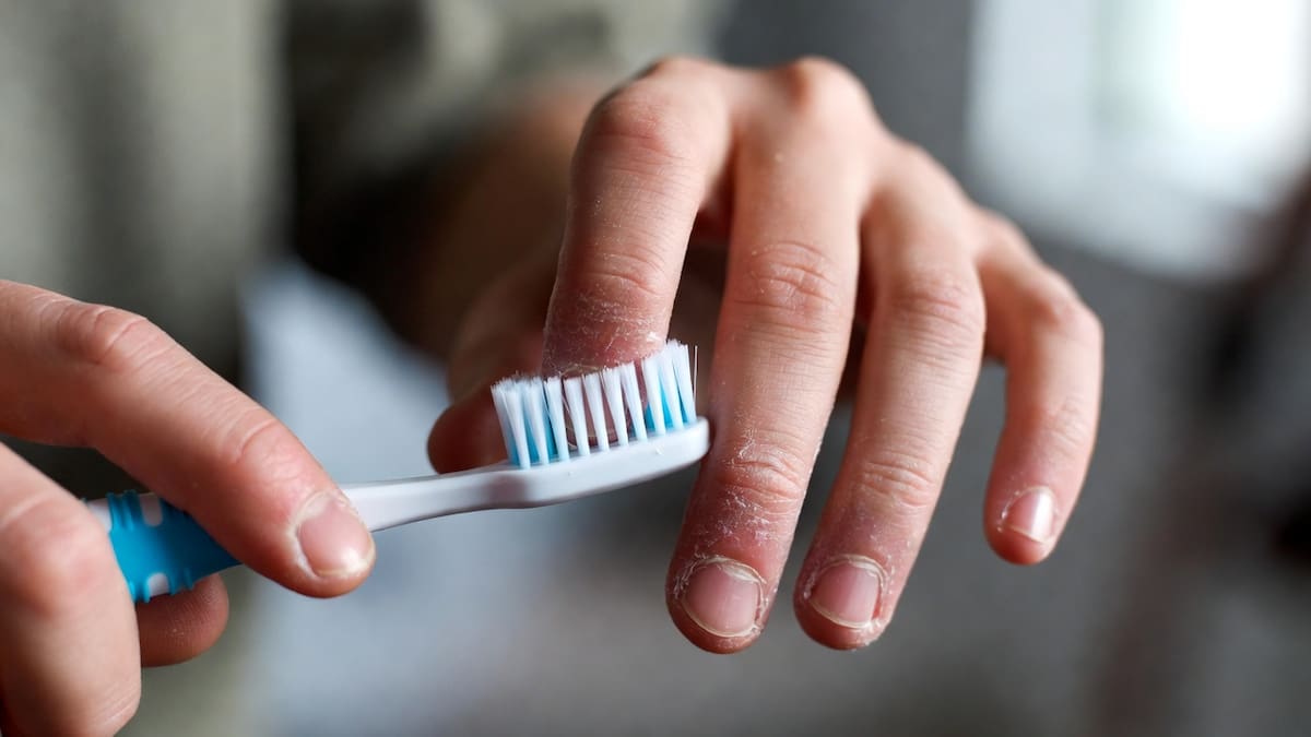 Aunque lavarse los dientes es una buena práctica, cepillarse inmediatamente después de consumir alimentos ácidos puede acelerar el desgaste, ya que el esmalte aún está reblandecido. Foto: Grok