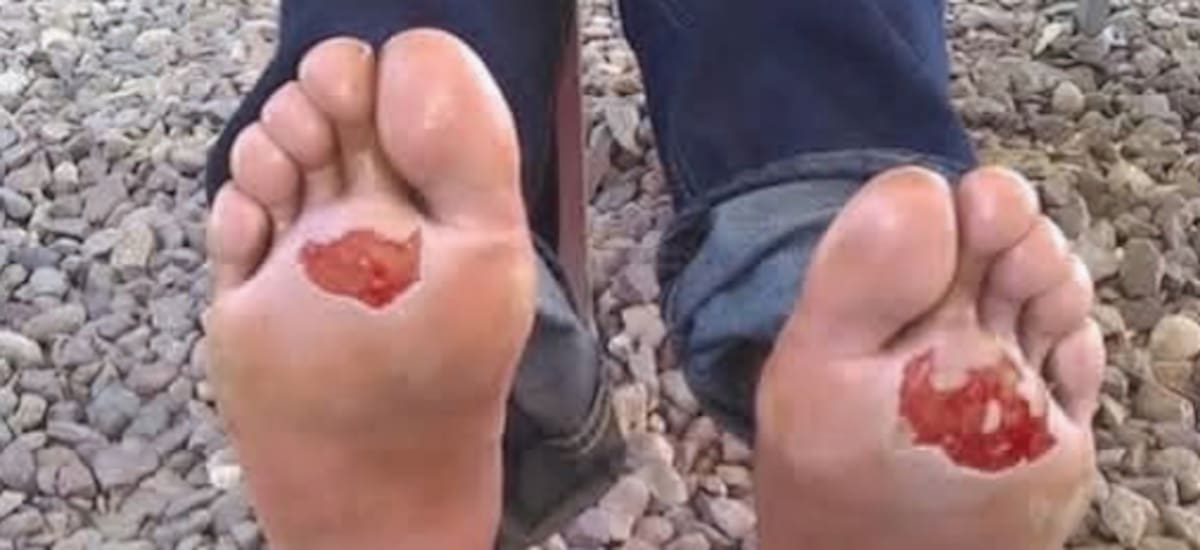 Pies lacerados de una persona migrante que buscaba llegar a EE.UU. Foto: Especial