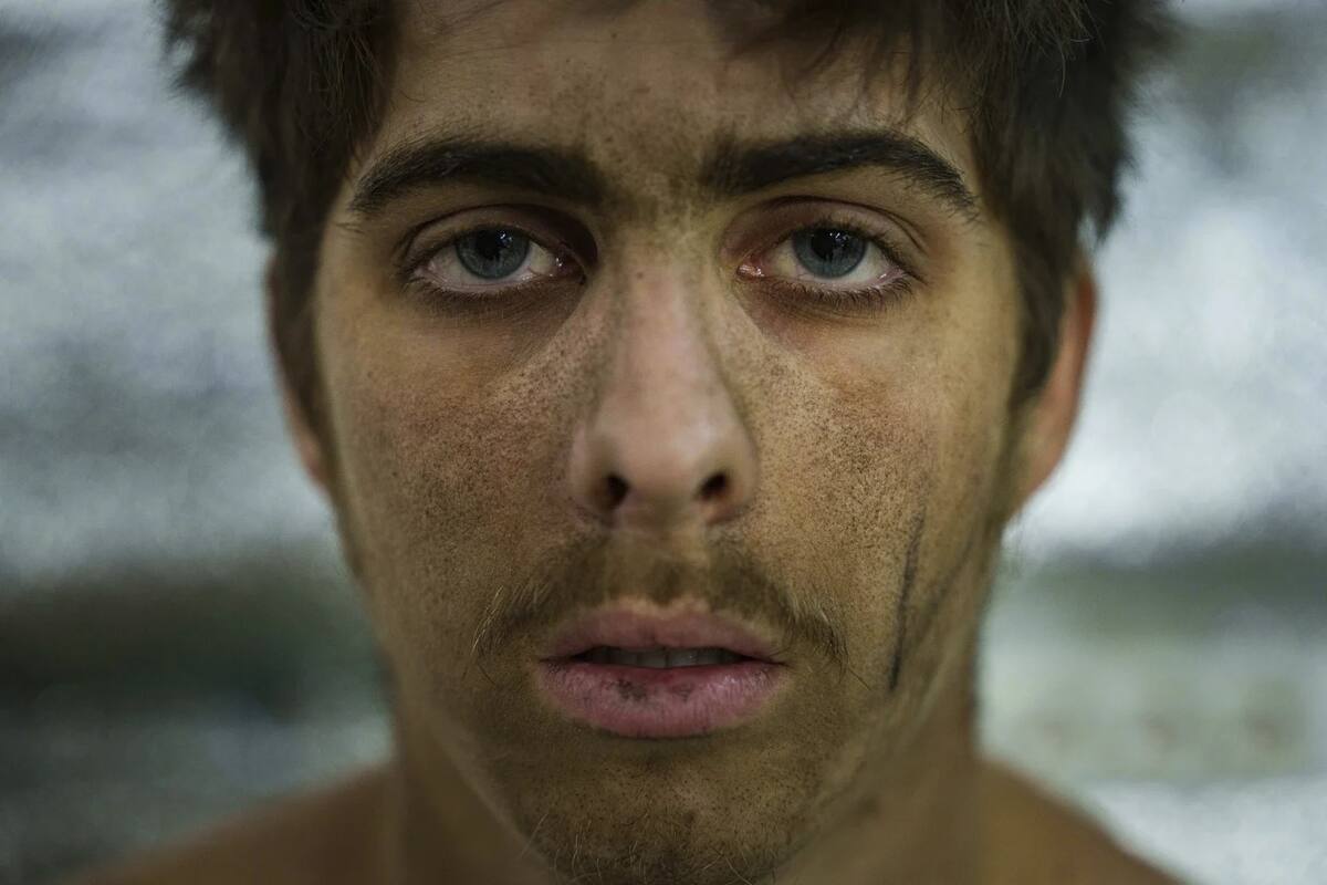 ARCHIVO - Un soldado ucraniano de la brigada Azov, conmocionado por la guerra, se sienta en el punto de estabilización después de llegar desde la línea del frente, cerca de Toretsk, región de Donetsk, Ucrania, el 24 de septiembre de 2024. | Crédito: AP/Evgeniy Maloletka, Archivo