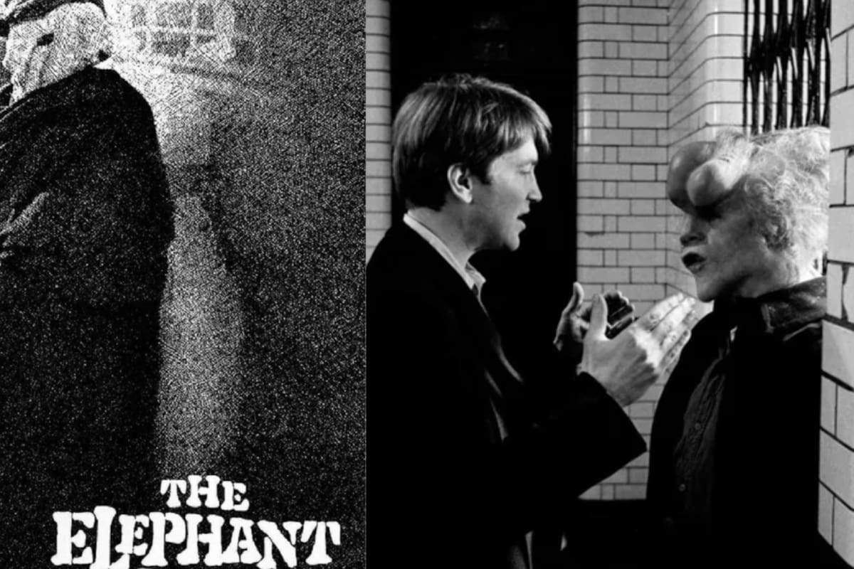 El Hombre Elefante: ¿Fue real? Descubre la inspiración detrás de esta famosa película