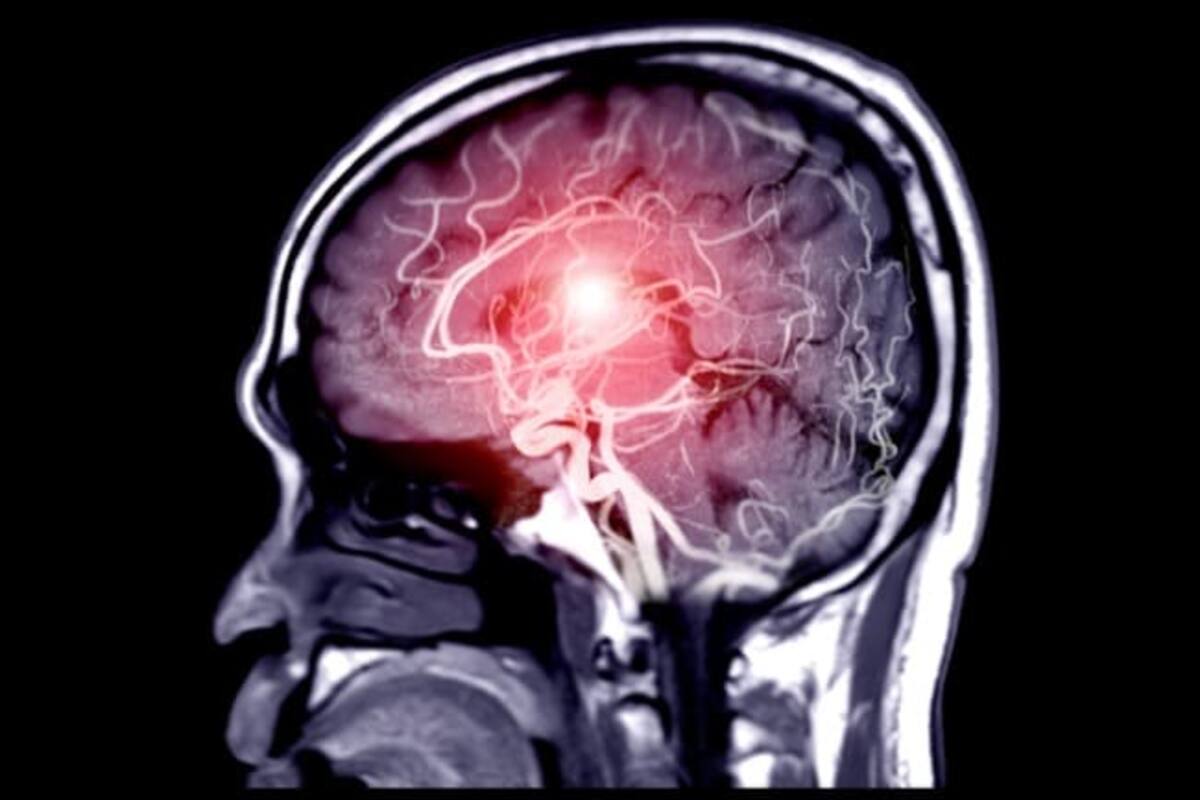 Música ayuda como terapia para personas con demencia avanzada según Universidad Anglia Ruskin