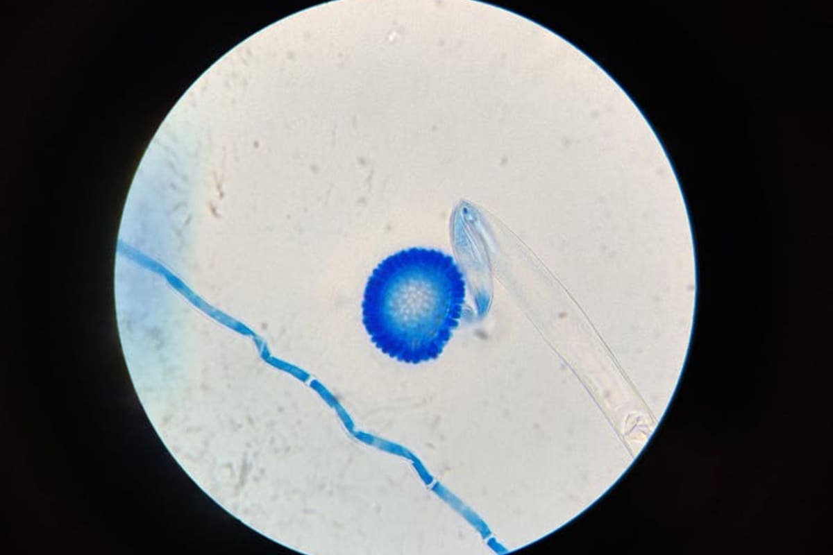 Científicos hallan la manera de combatir un hongo altamente resistente que afecta a pacientes hospitalizados