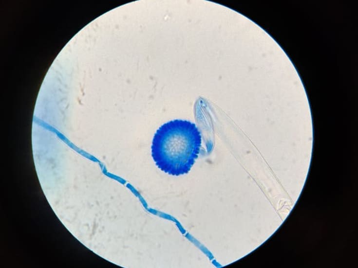 Científicos hallan la manera de combatir un hongo altamente resistente que afecta a pacientes hospitalizados