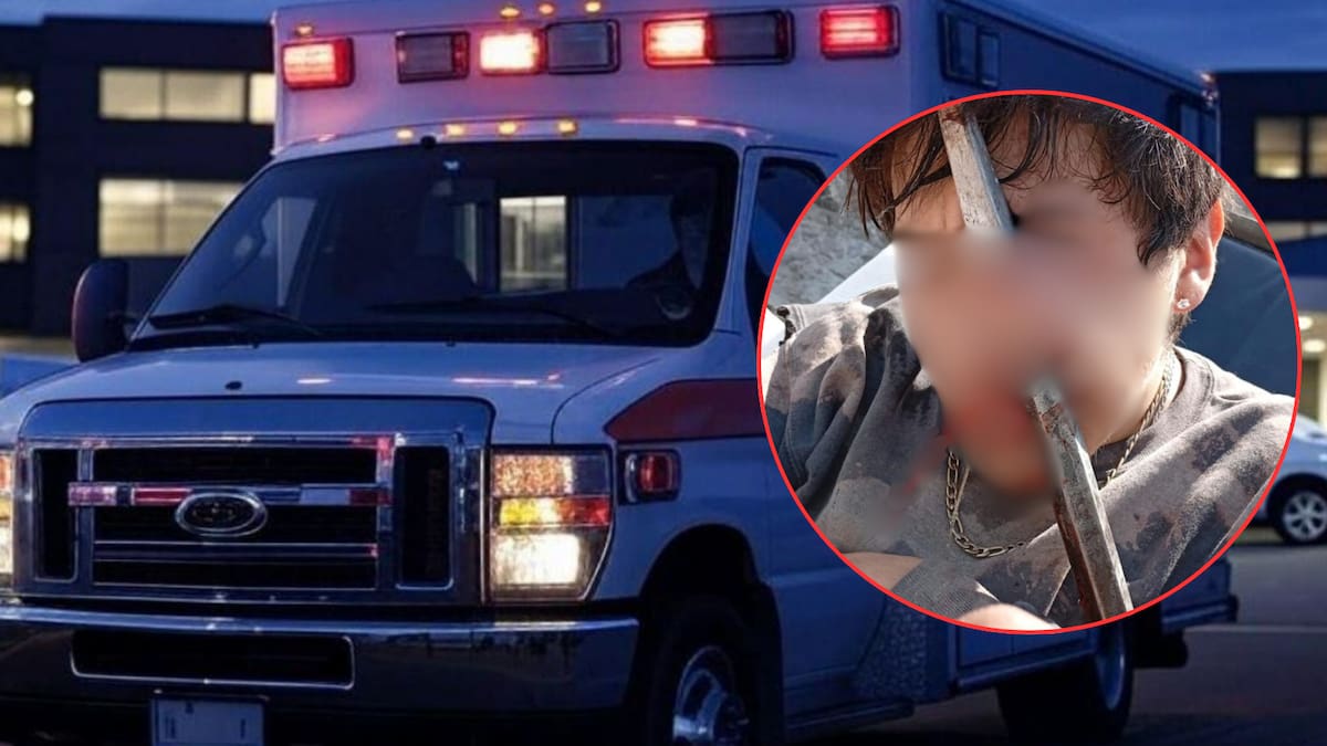 Joven de 18 años sobrevive después de que una barra metálica le atravesó la cara en obra de Tláhuac