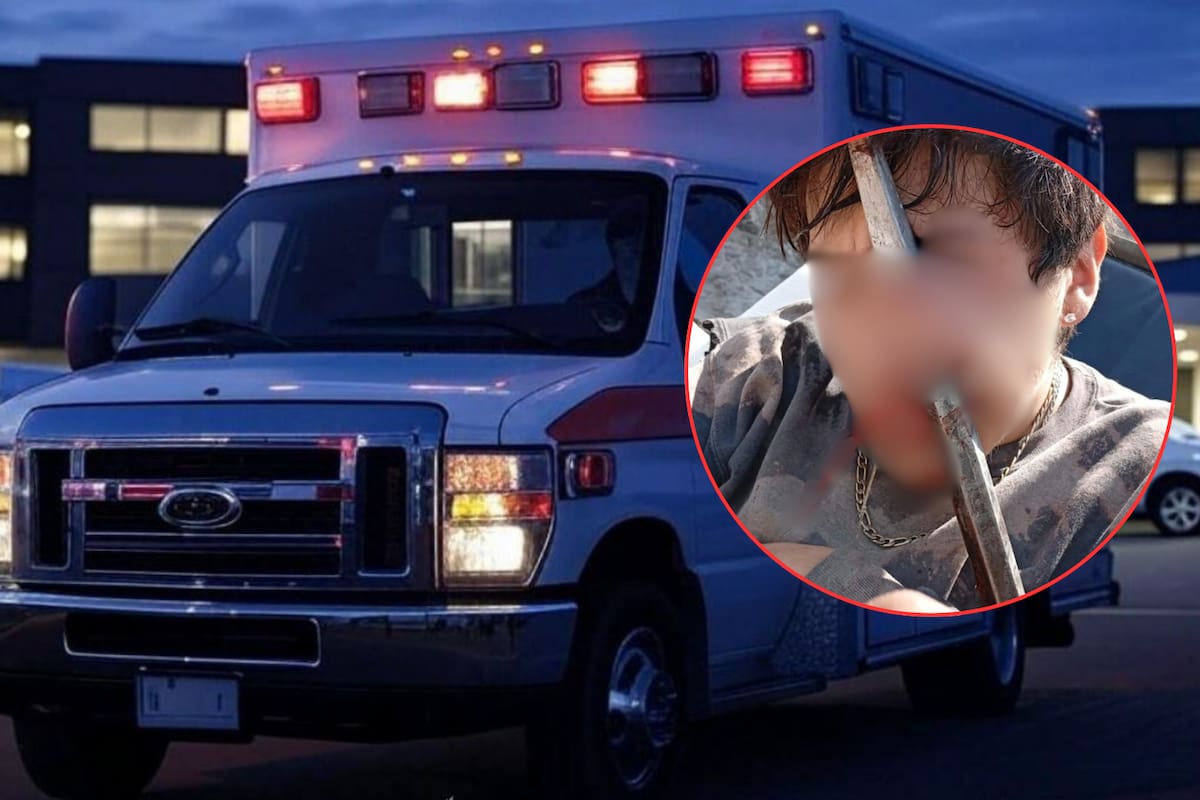 Joven de 18 años sobrevive después de que una barra metálica le atravesó la cara en obra de Tláhuac