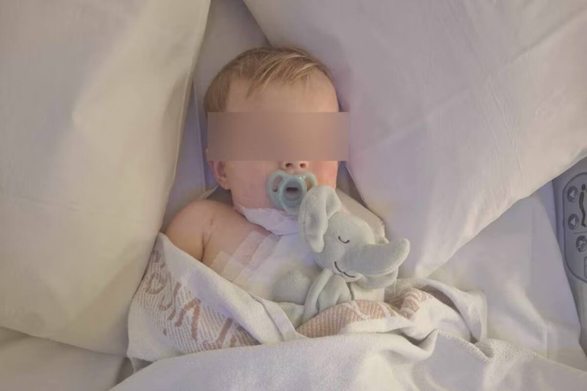 Un bebé de 9 meses sufrió múltiples quemaduras muy graves. FOTO: Especial