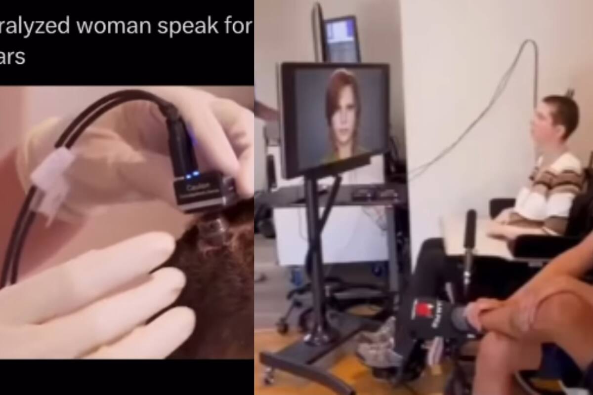 ‘Pasaron 18 años para este momento’: Mujer con parálisis logra hablar gracias a la inteligencia artificial y la tecnología