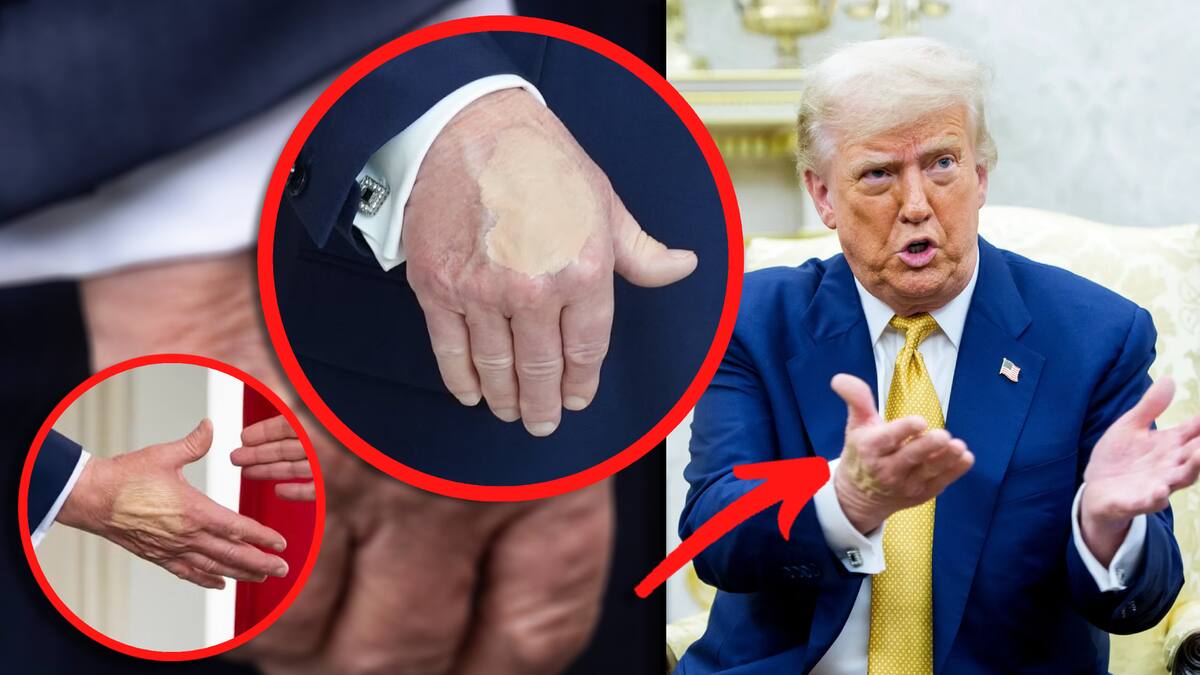 Fotos virales muestran grandes manchas de maquillaje en las manos del presidente. FOTO: Especial