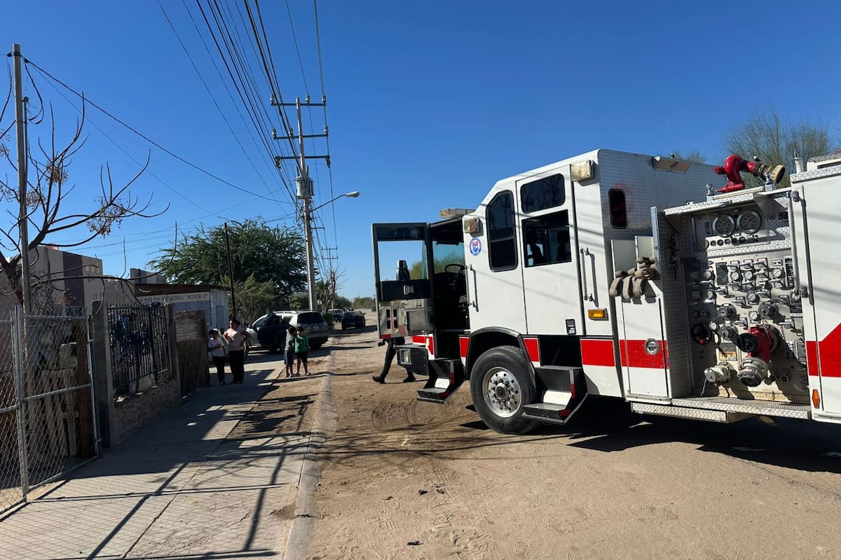 Persona resulta con quemaduras tras incendio