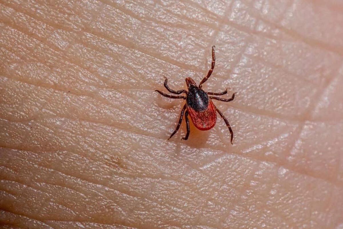 Van seis muertes por rickettsia en Baja California