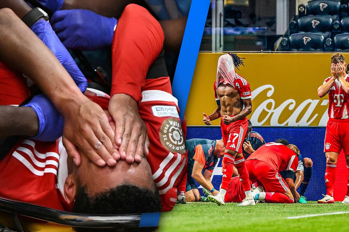 ¿Cuánto tiempo estará fuera Jamal Musiala tras su impactante lesión?