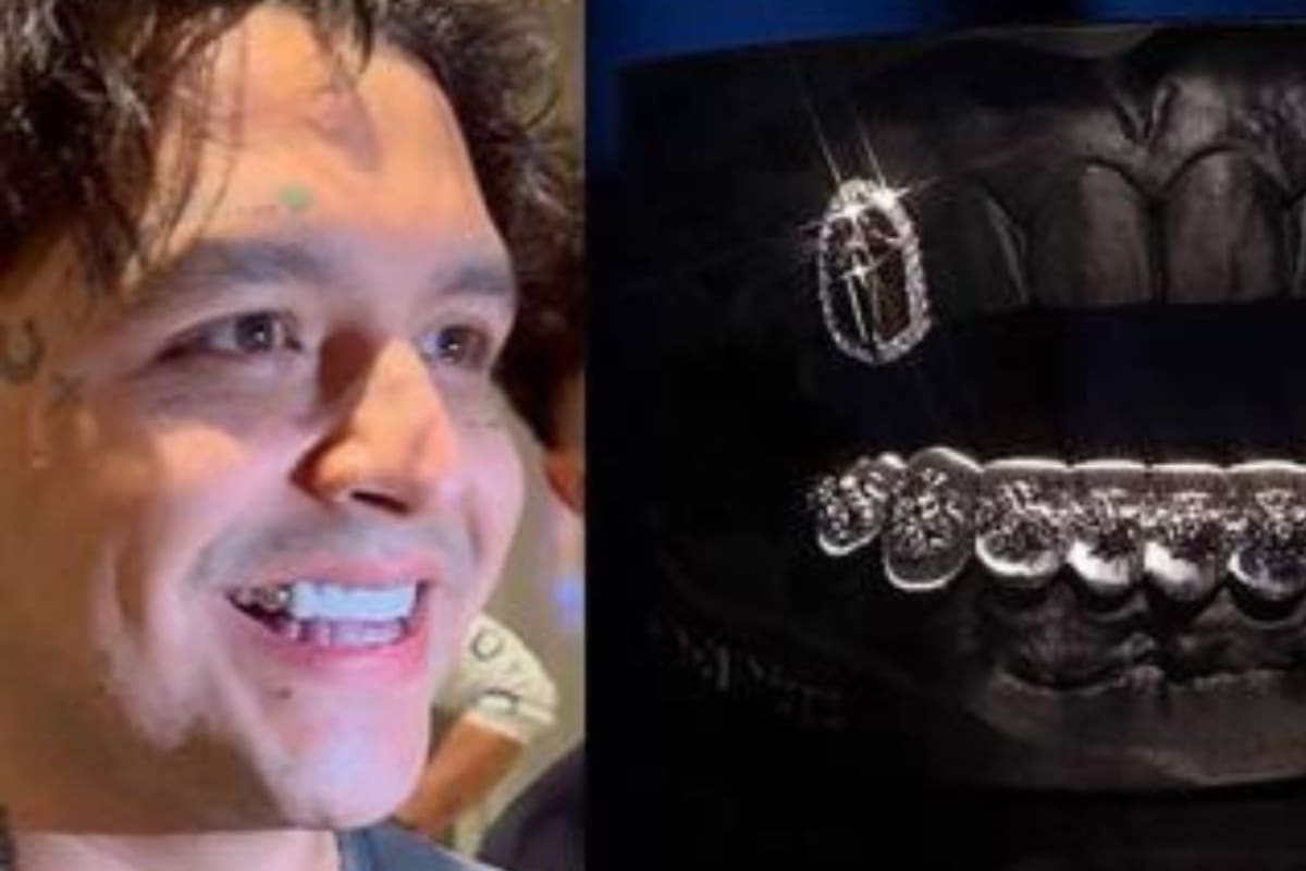 Christian Nodal arrepentido de quitarse las muelas y poner diamantes en su lugar, gastó 800 mil dólares