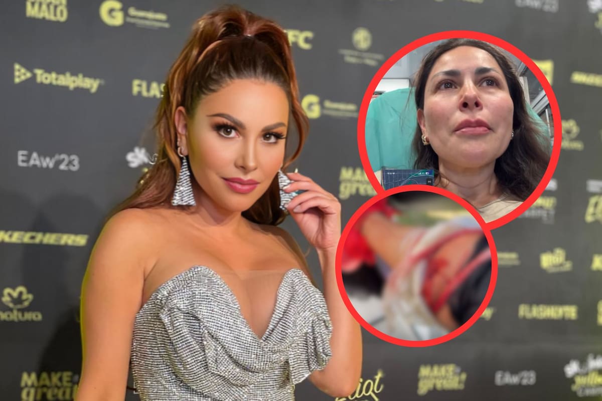 Hospitalizan de emergencia a Gaby Ramírez tras ser brutalmente atacada por un perro en EEUU