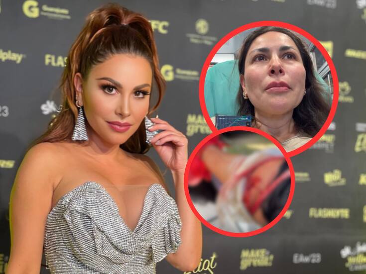 Hospitalizan de emergencia a Gaby Ramírez tras ser brutalmente atacada por un perro en EEUU