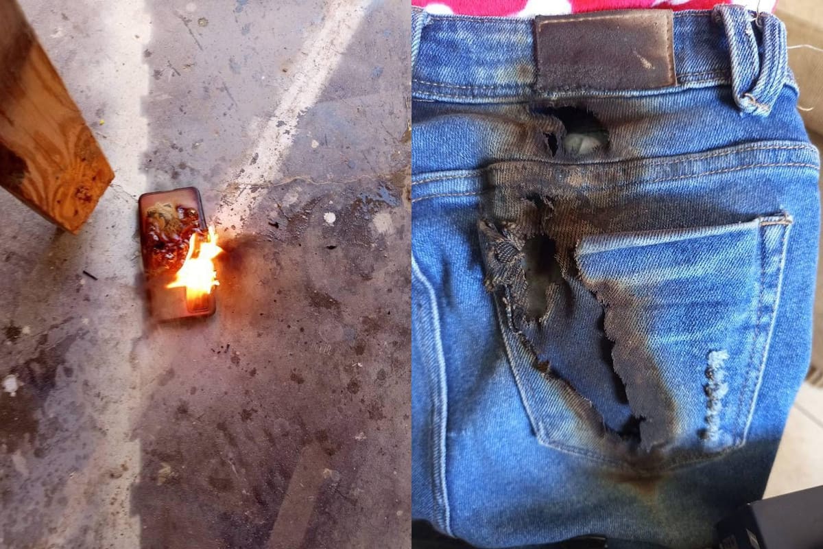Mujer sufre quemaduras de segundo grado tras explosión de celular en Puerto Peñasco