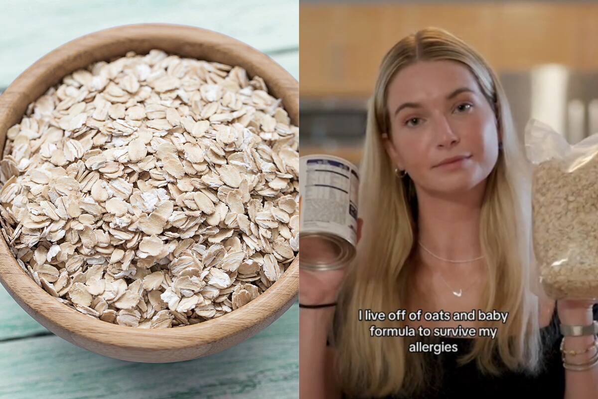 El porque esta mujer solo puede comer avena todos los días, aún en Navidad: “Soy alérgica a todo”