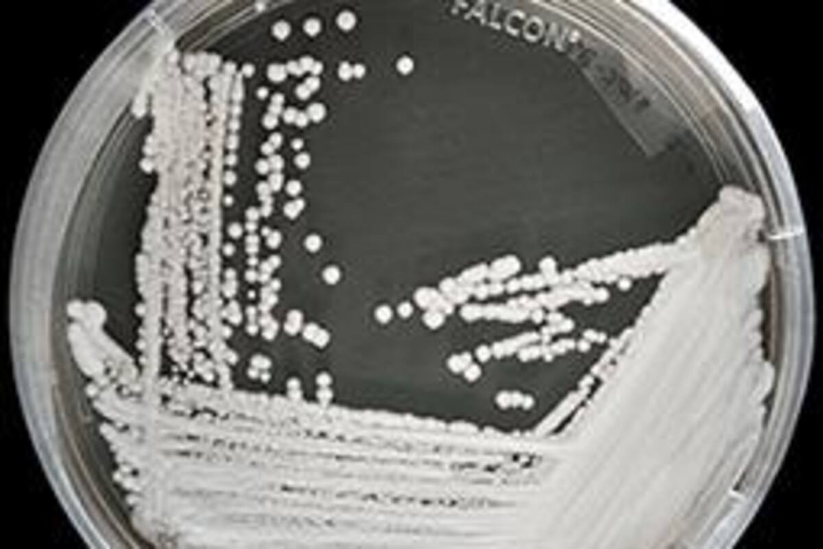 Candida Auris: Lo que debes saber del "Super hongo" resistente a medicamentos