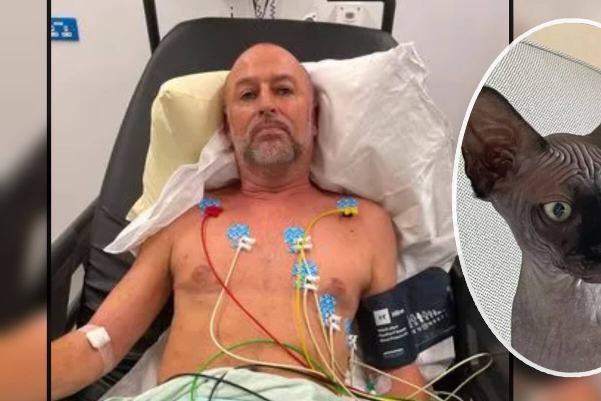 Hombre tropezó con su gato y le dejó lesiones similares a las de un fuerte accidente automovilístico: “Tengo suerte de estar vivo”