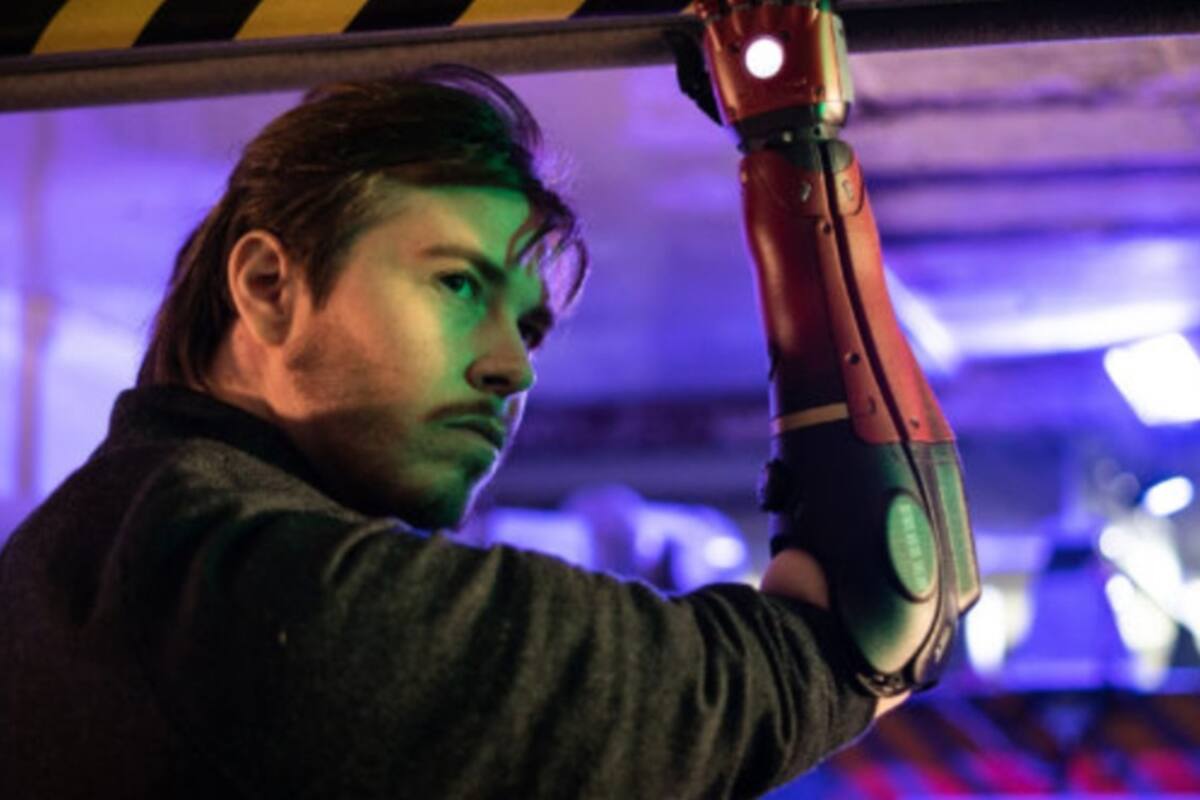 Nació sin brazo pero ahora usa uno biónico de 'Metal Gear Solid'