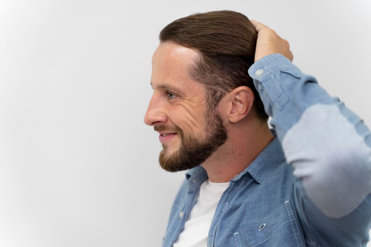 ¿Cuánto tiempo tardan en verse los resultados reales del injerto de cabello?
