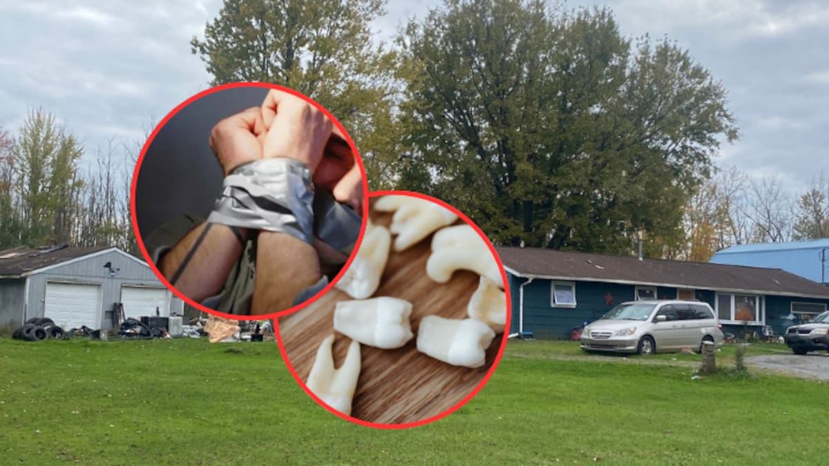 Hombre secuestrado utilizó uno de los dientes que le arrancaron para cortar la cinta con la que estaba inmovilizado y huir de su captor en Estados Unidos