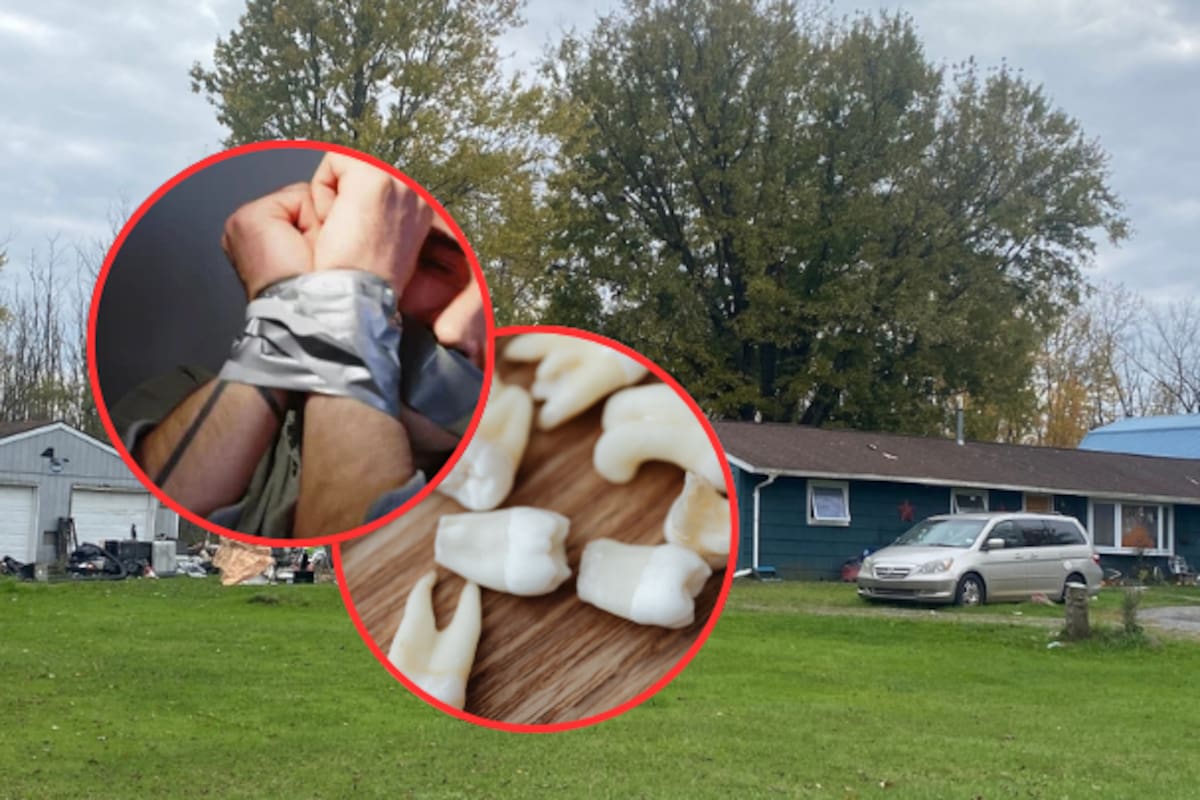 Hombre secuestrado utilizó uno de los dientes que le arrancaron para cortar la cinta con la que estaba inmovilizado y huir de su captor en Estados Unidos