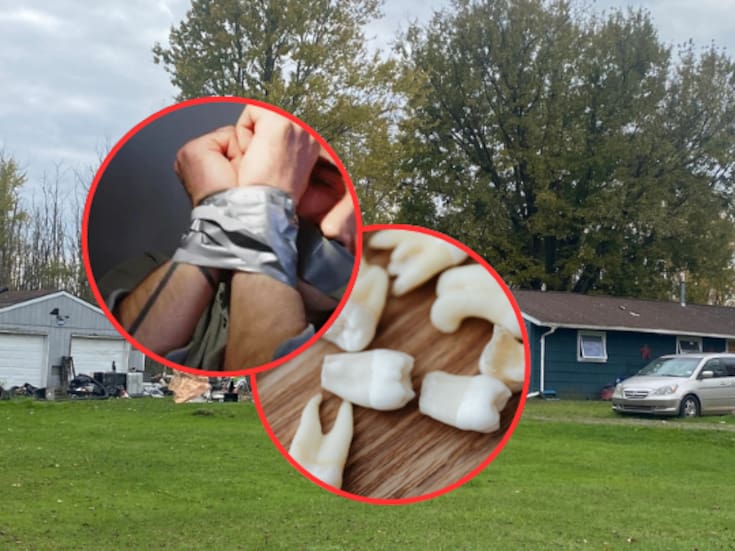 Hombre secuestrado utilizó uno de los dientes que le arrancaron para cortar la cinta con la que estaba inmovilizado y huir de su captor en Estados Unidos