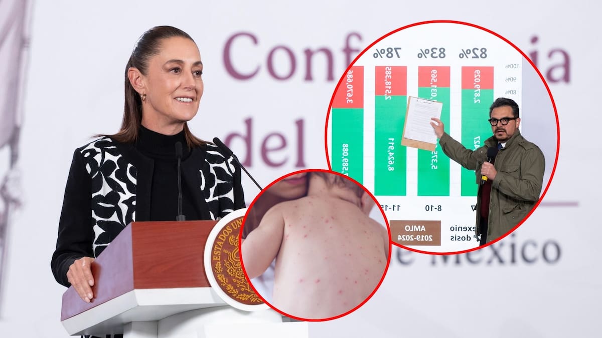 Sheinbaum llama a “guardar la calma” ante brote de sarampión; hay suficiente vacuna, dice