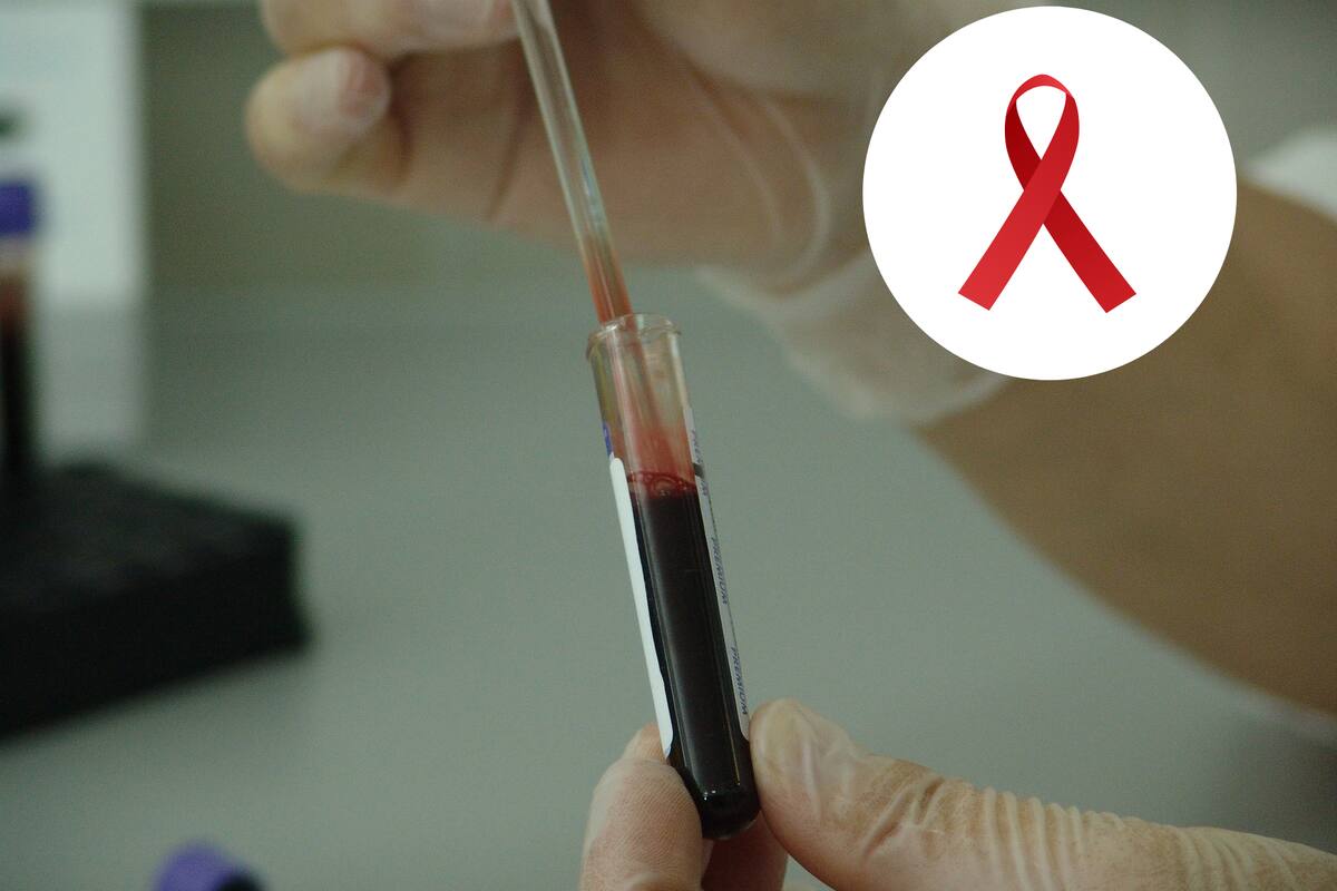 Lenacapavir para prevenir el VIH: el gran avance de 2024