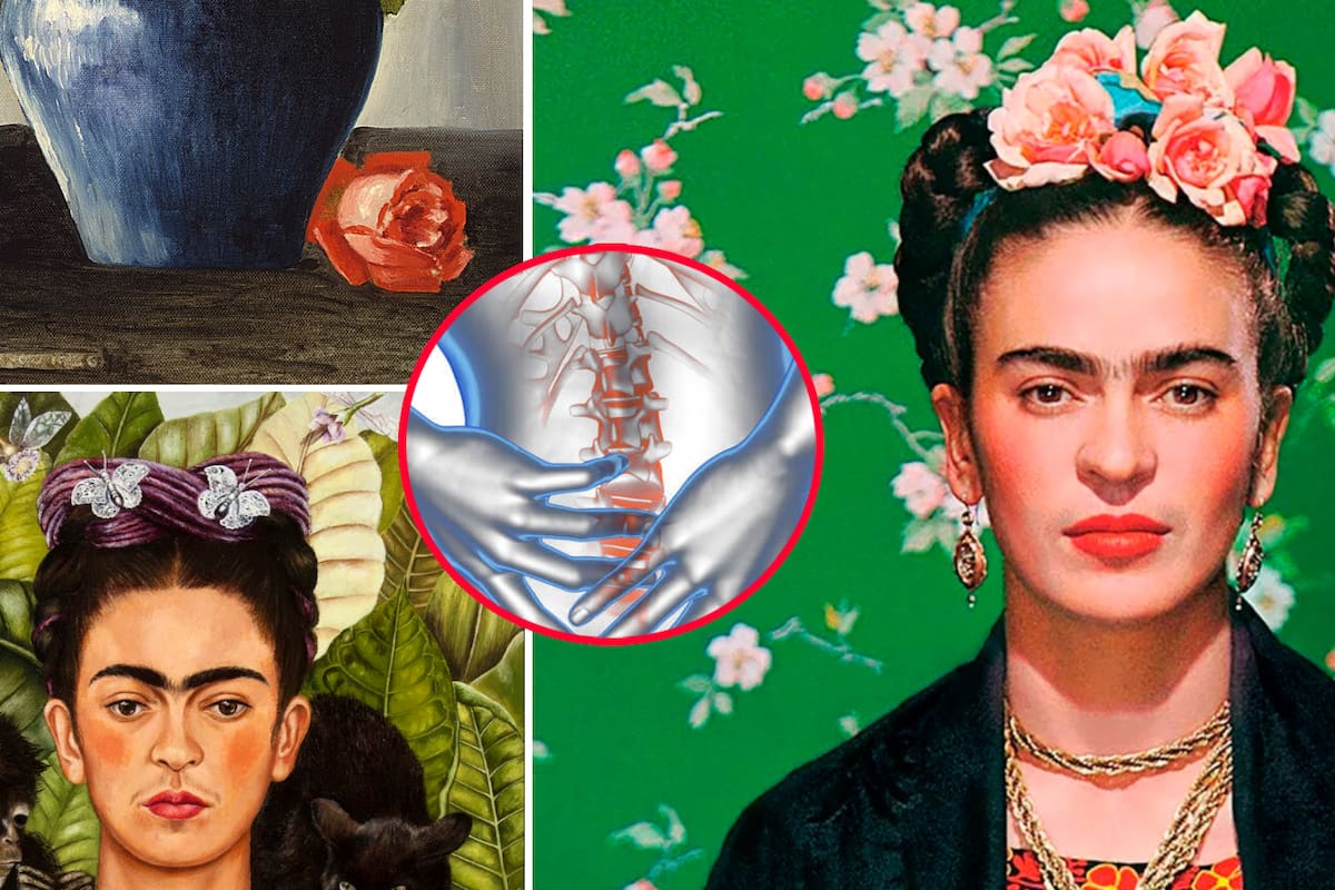 El nuevo diagnóstico de Frida Kahlo descubierto 70 años después: ¿Qué es el síndrome de cola de caballo?