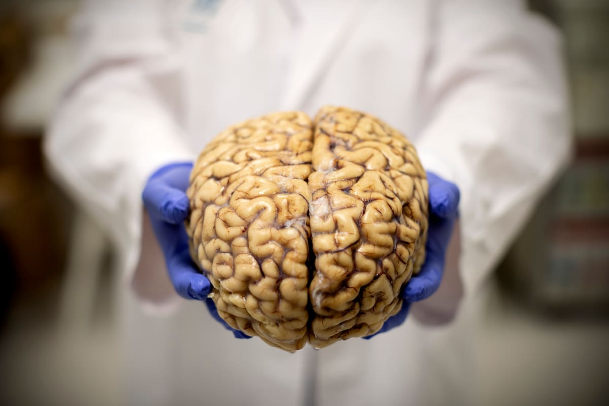 Científicos descubren cómo funciona el cerebro al tomar decisiones importantes