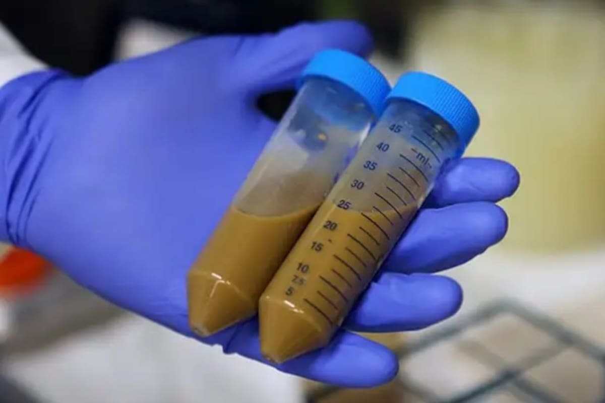 Trasplantes de heces podrían convertirse en un tratamiento contra el Covid-19