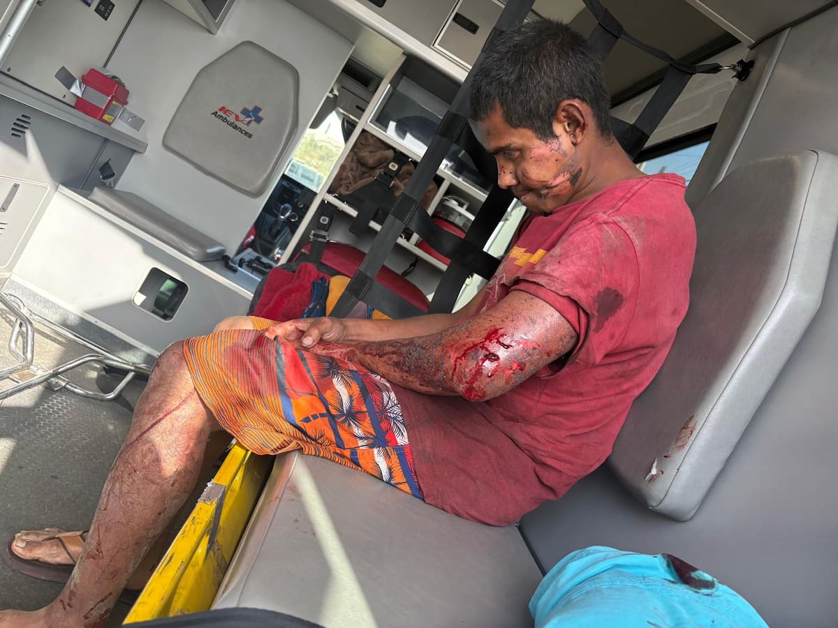 Un migrante fue víctima de un intento de asesinato en la colonia Nueva Esperanza; activistas exigen a autoridades reforzar seguridad y atender la vulnerabilidad de personas en contexto de movilidad. Foto:Khennia Reyes