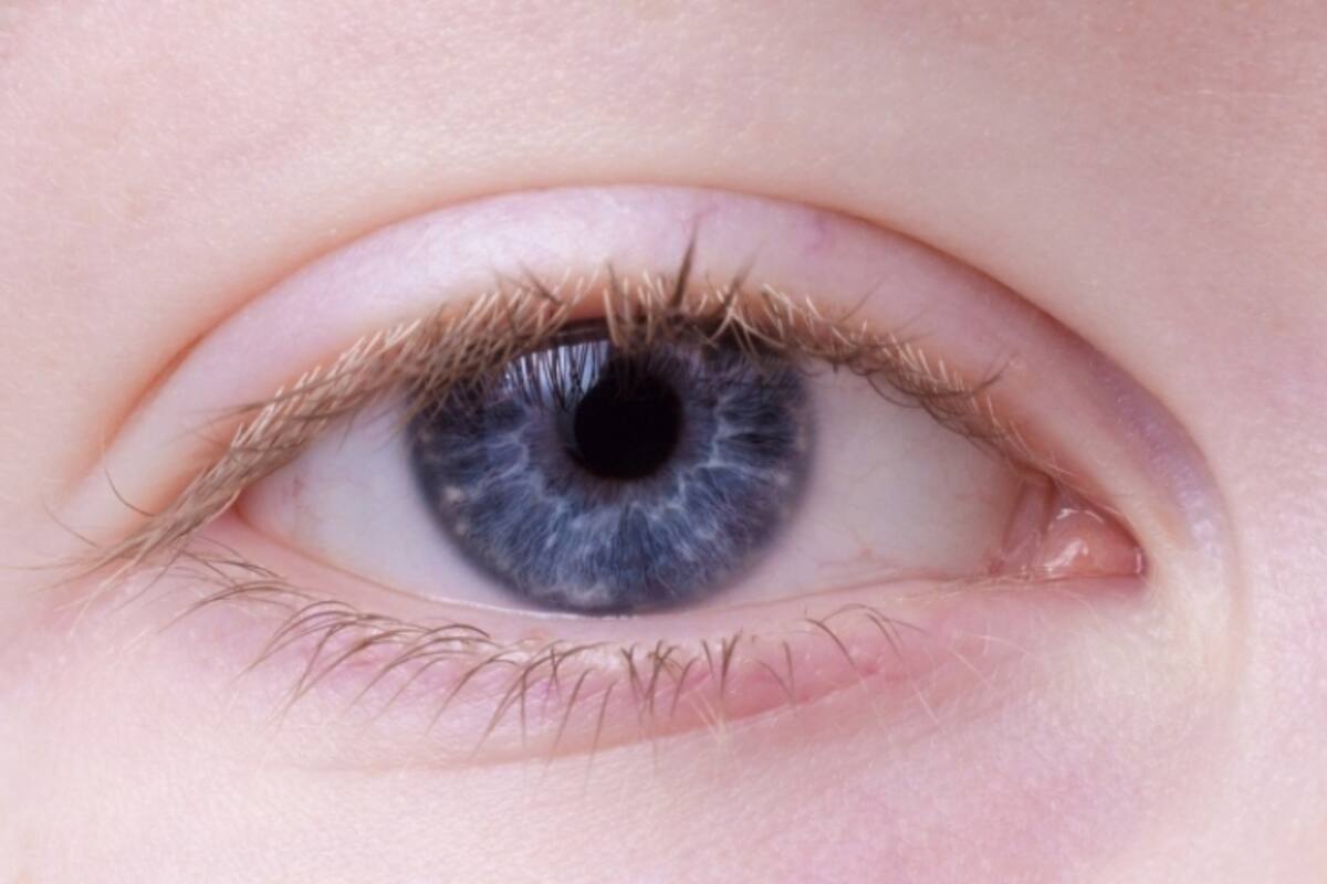 Causas y tratamientos de párpados hinchados