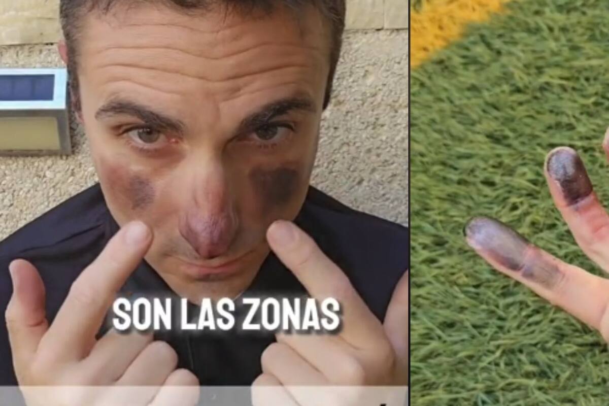 Zonas de congelación: Conoce qué son y cómo debes actuar en caso de que te suceda