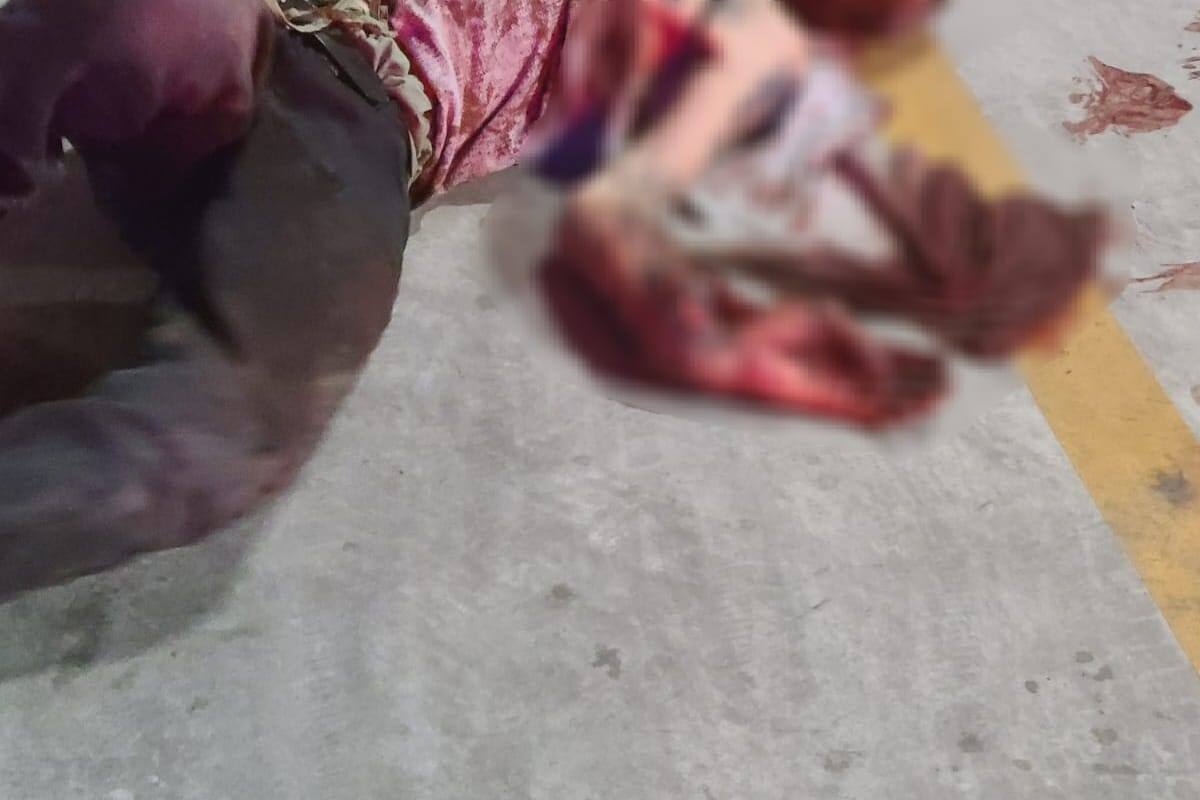Hombre sufre ataque de perro en Pueblo Nuevo