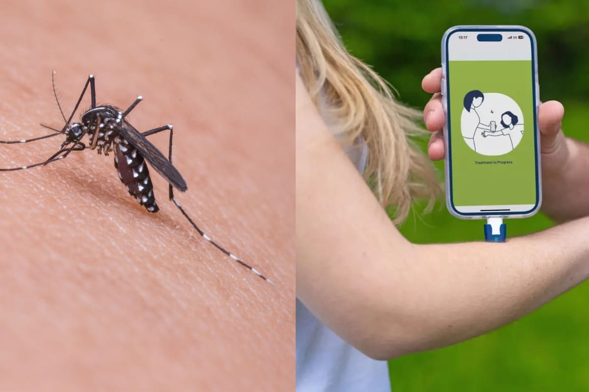 Este nuevo eliminador de picaduras se conecta a tu celular: así funciona para aliviar la comezón en segundos