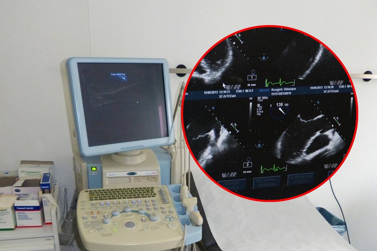 Primer tratamiento en el útero para un trastorno genético raro muestra resultados prometedores