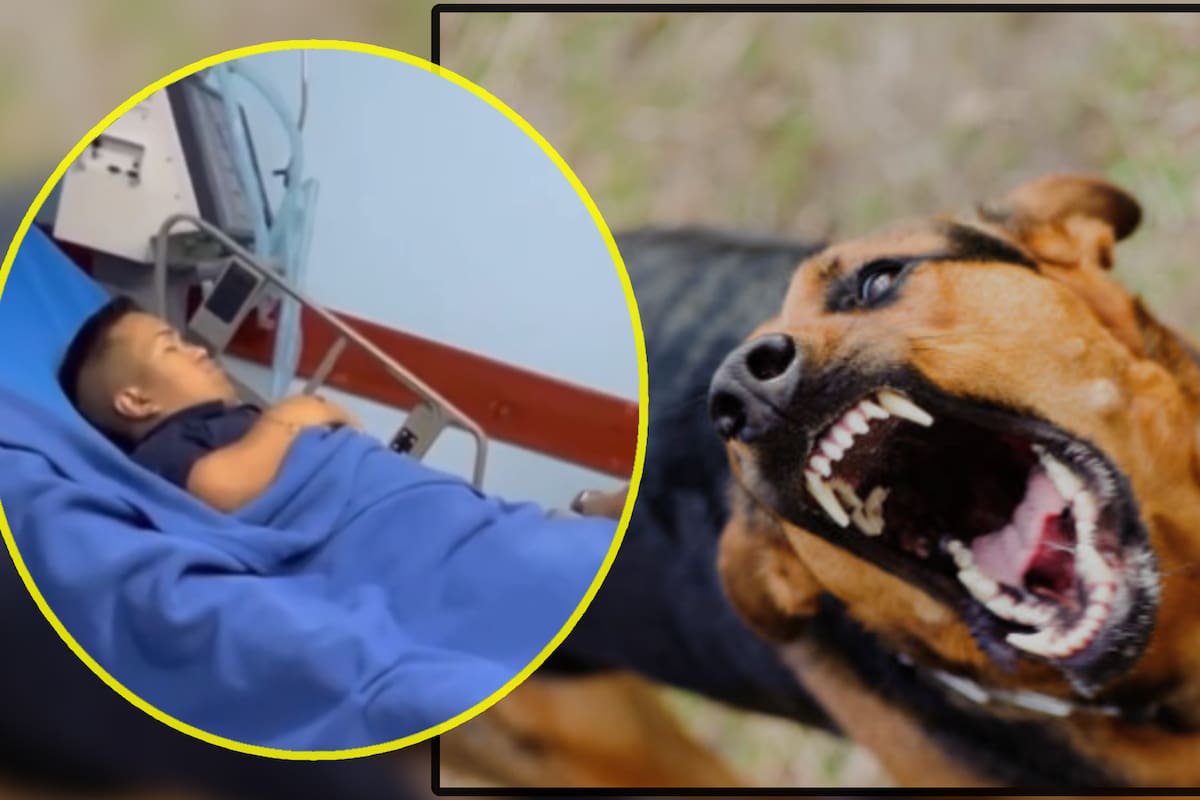 Medio Metro es hospitalizado de emergencia tras ser atacado por un perro rabioso y convulsionarse