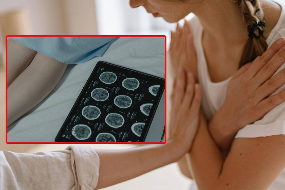 EU: Mujer visita al quiropráctico por dolores en el cuello y luego sufre un derrame cerebral; revelan la causa