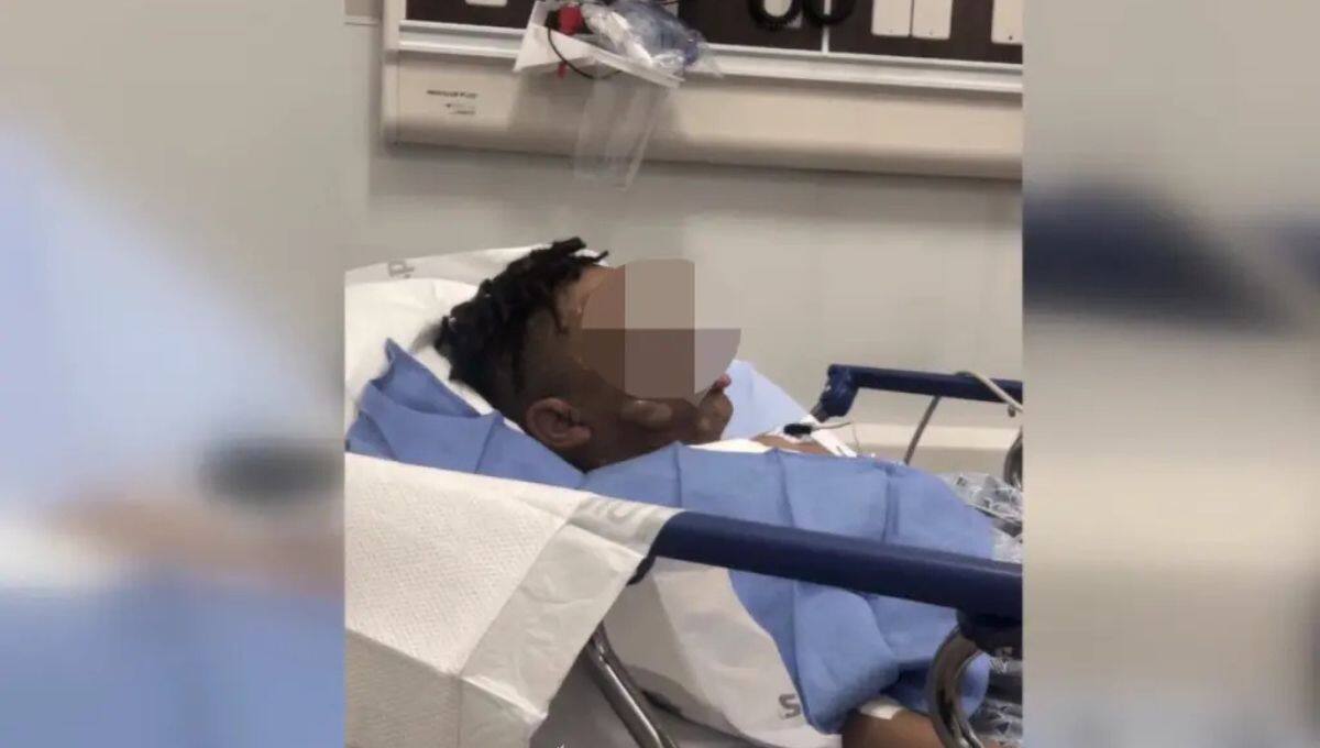 Niño de 12 años sufre quemaduras graves