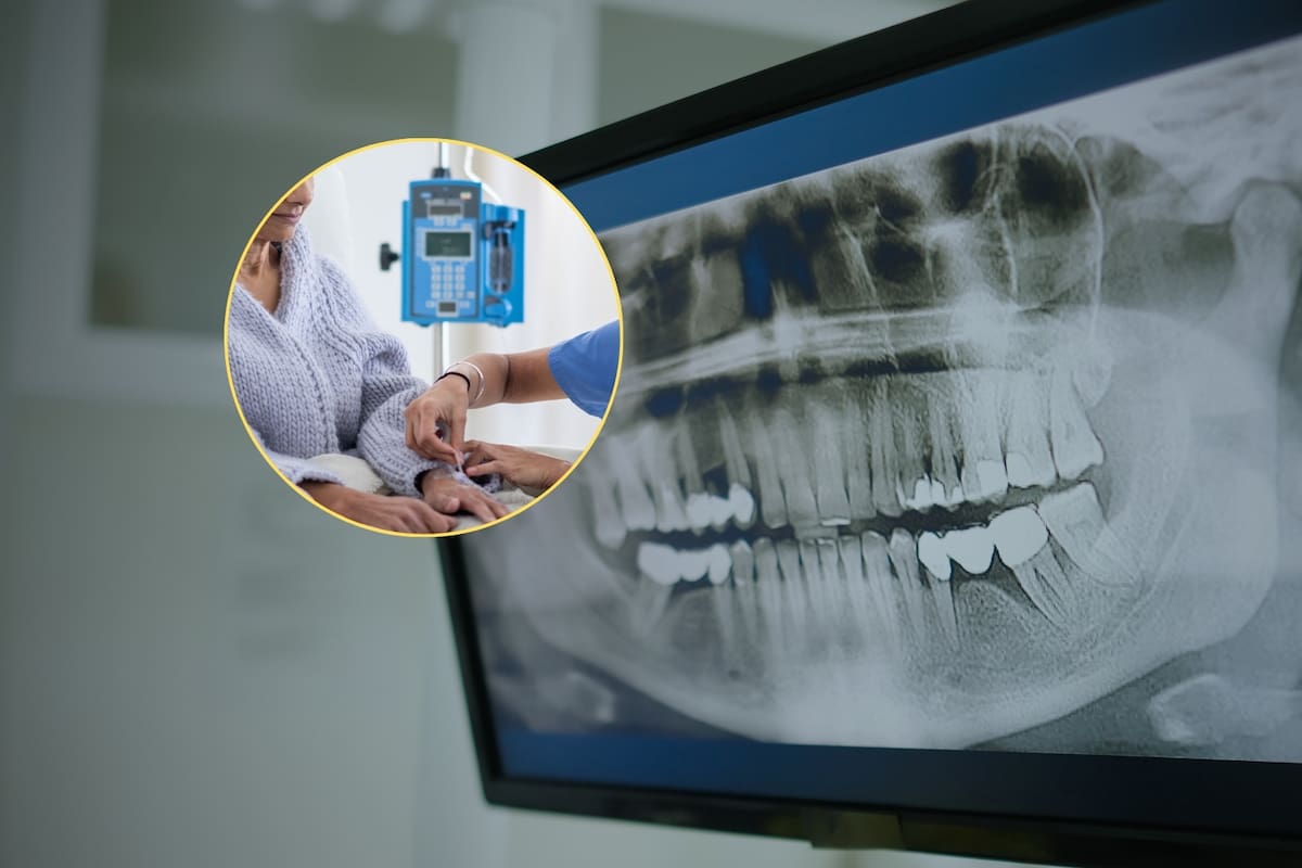 Científicos advirtieron que las bacterias bucales pueden influir en el desarrollo y progresión de cáncer y otras enfermedades complejas