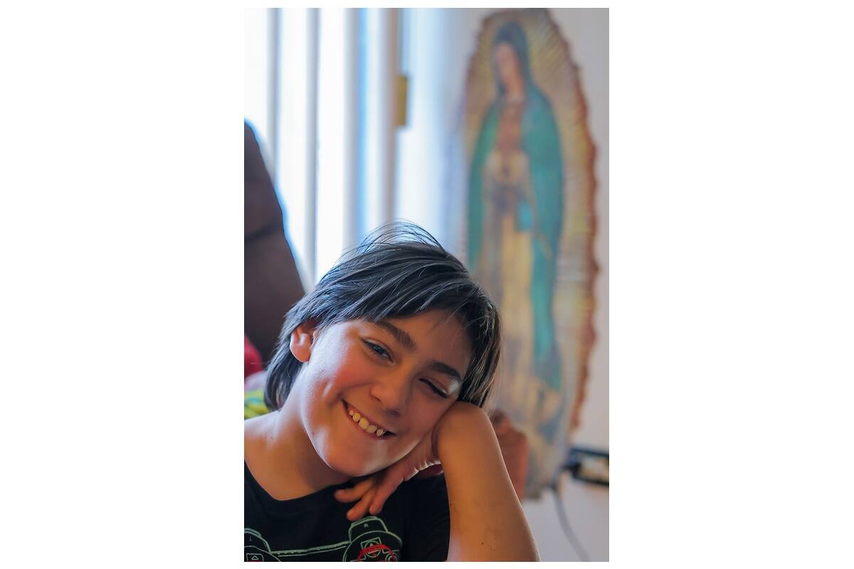 Marko es uno en un millón: tiene uno de los síndromes más raros del mundo